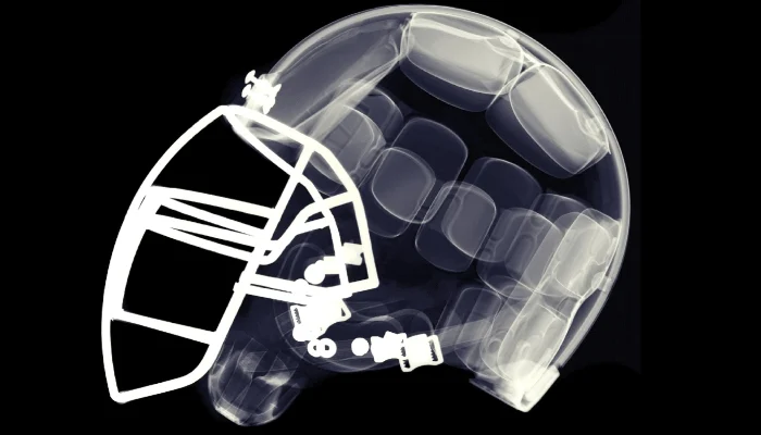  Former NFL players faced four times higher neurodegenerative death rate, study finds